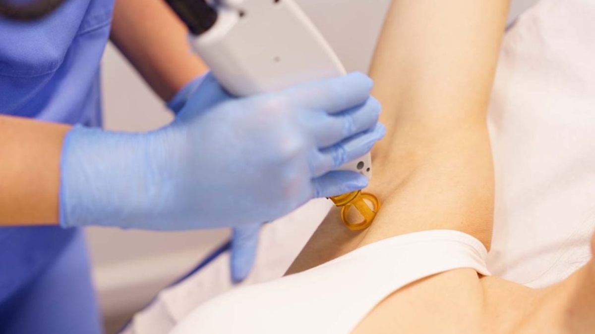 Alexandrite-Laser-Hair-Removal-
